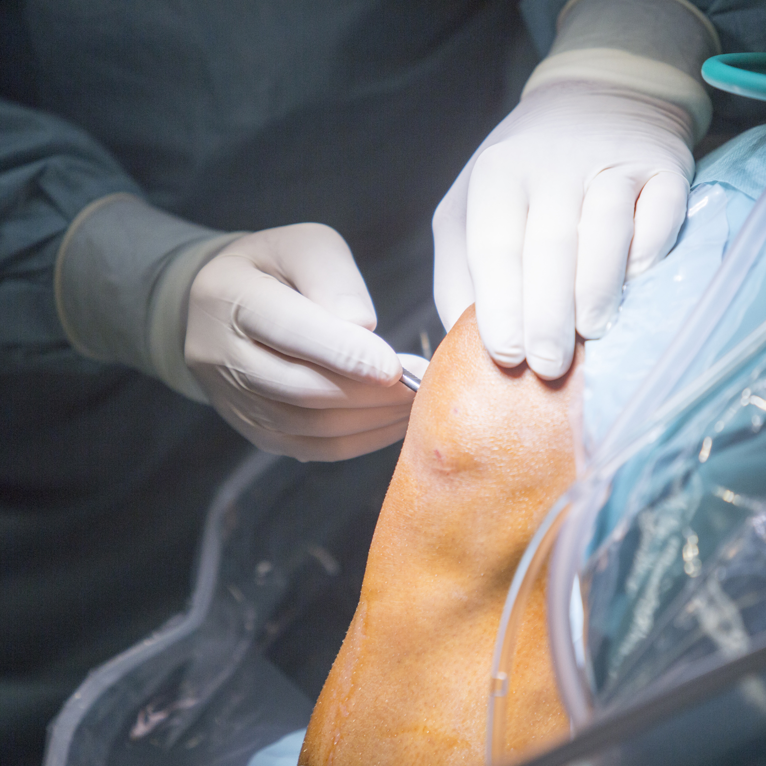 Best orthopedic surgeon in Punawale