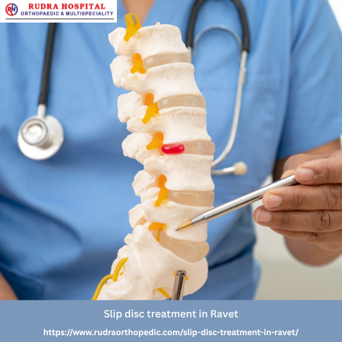 Slip disc treatment in Ravet